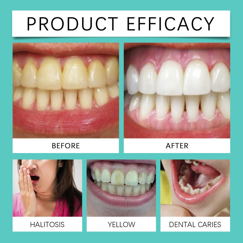 SmileBright – Enamel-friendly teeth whitening strips | 7+7 pairs